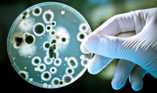 细菌的保存方法（细菌的保存方法甘油名称）